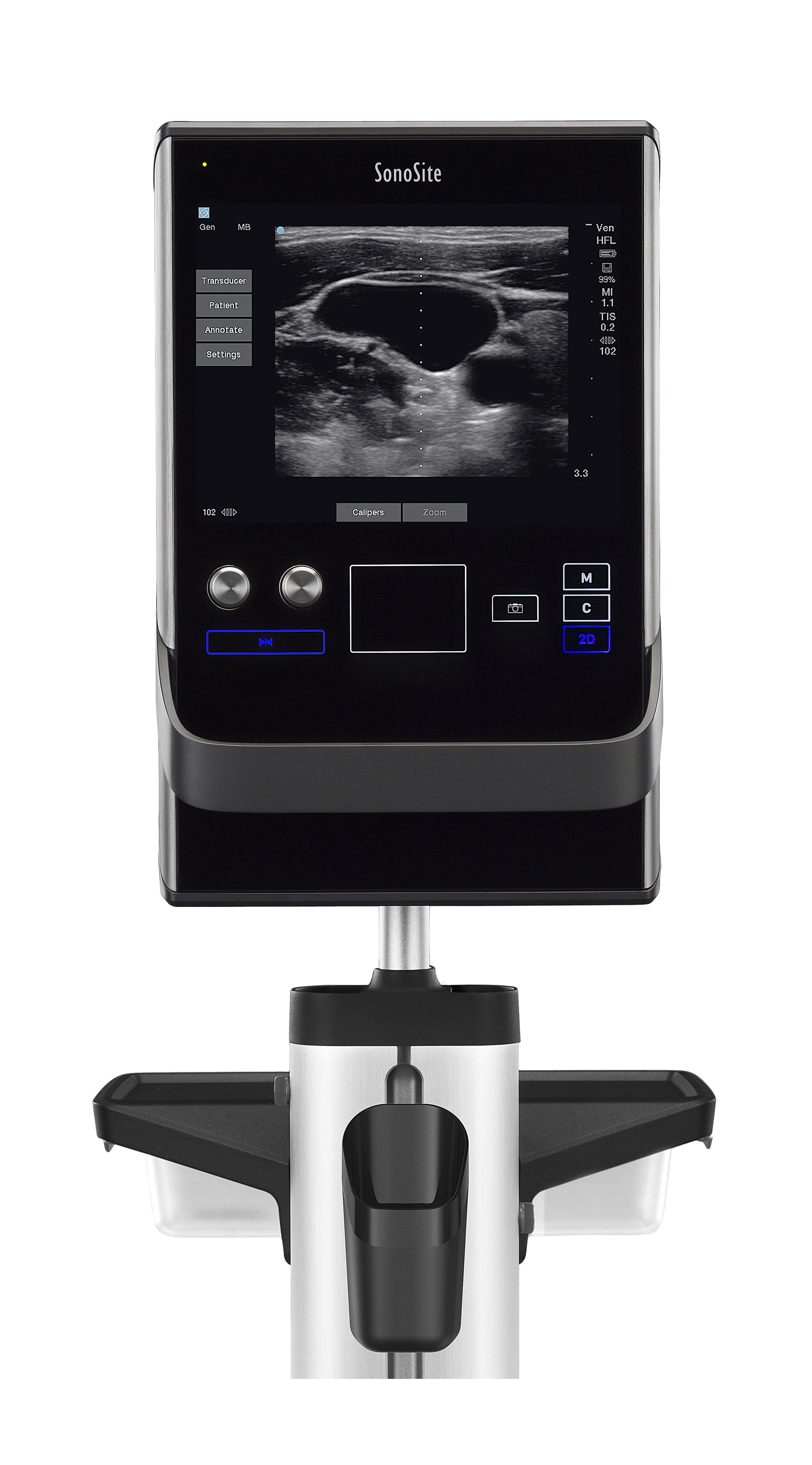 Sonosite SII