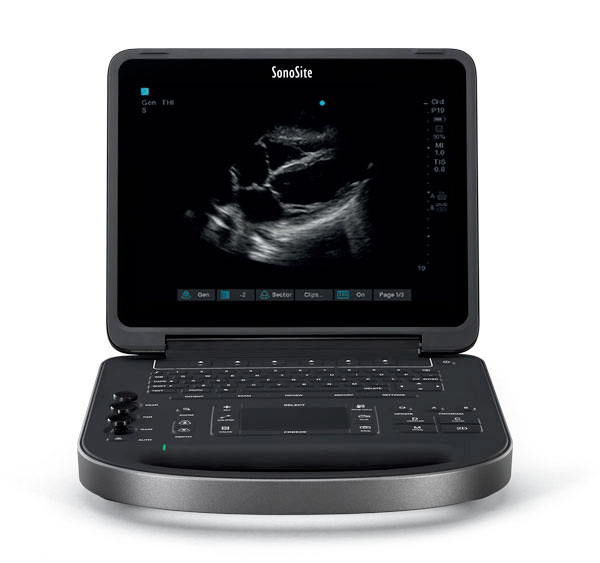 Sonosite Edge II