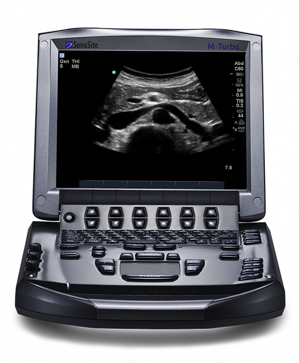 Sonosite M-Turbo