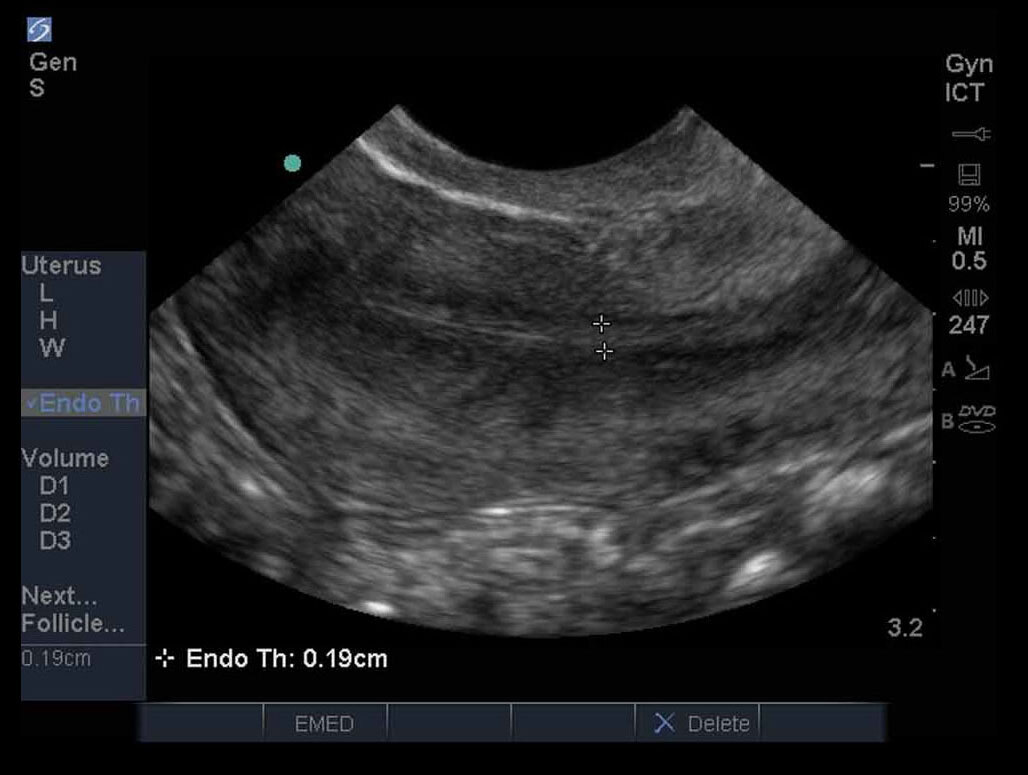Female Pelvis 03