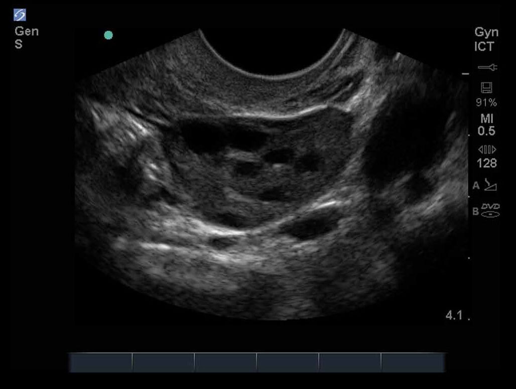 Female Pelvis 07