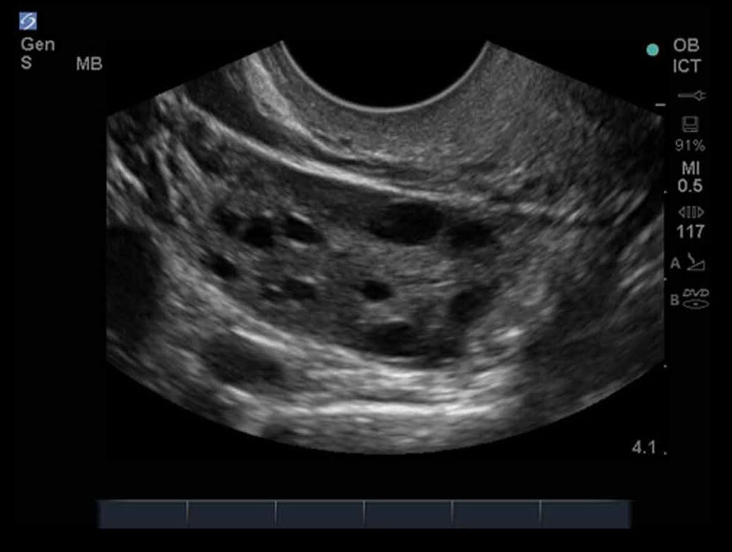 Female Pelvis 08