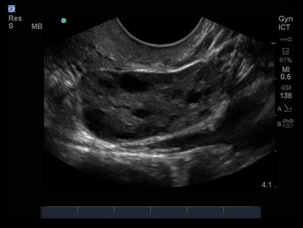 Female Pelvis 09