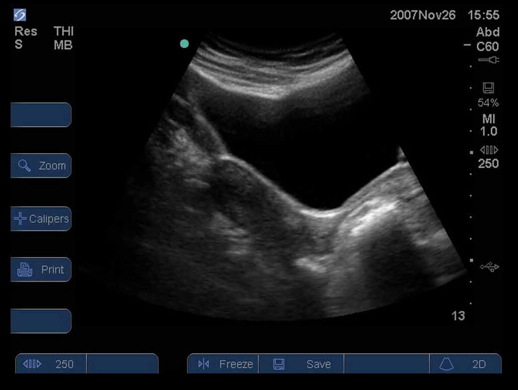 Female Pelvis 12
