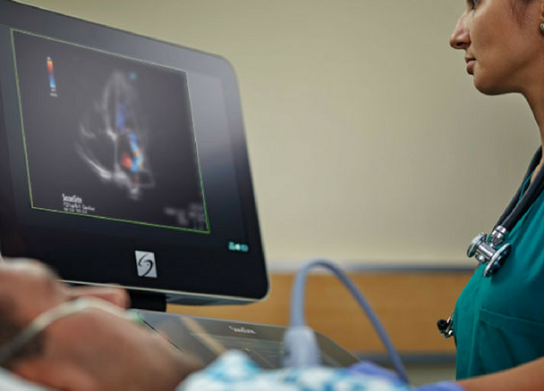 L'échographie permet une imagerie cardiaque précise